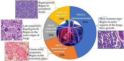 Everything Old Is New Again: Drug Repurposing Approach for Non-Small Cell Lung Cancer Targeting MAPK Signaling Pathway